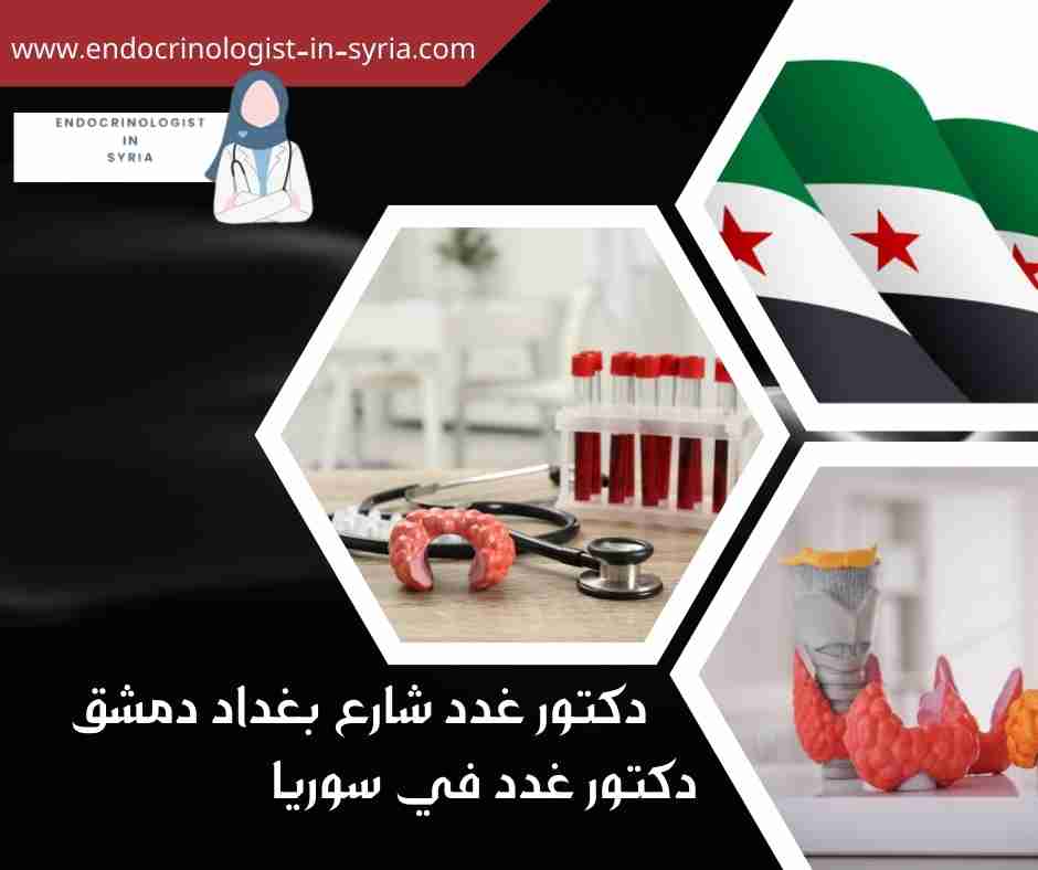 دكتور غدد شارع بغداد دمشق