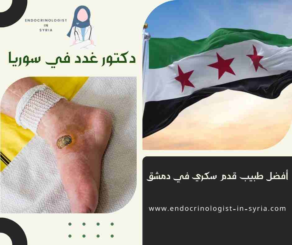 أفضل طبيب قدم سكري في دمشق