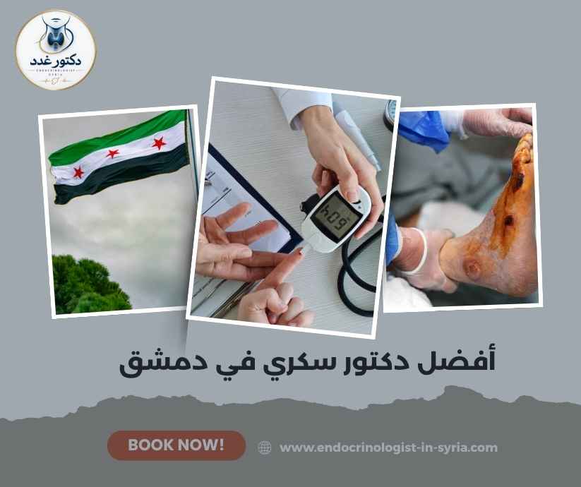 أفضل دكتور سكري في دمشق أفضل دكتور سكري في دمشق