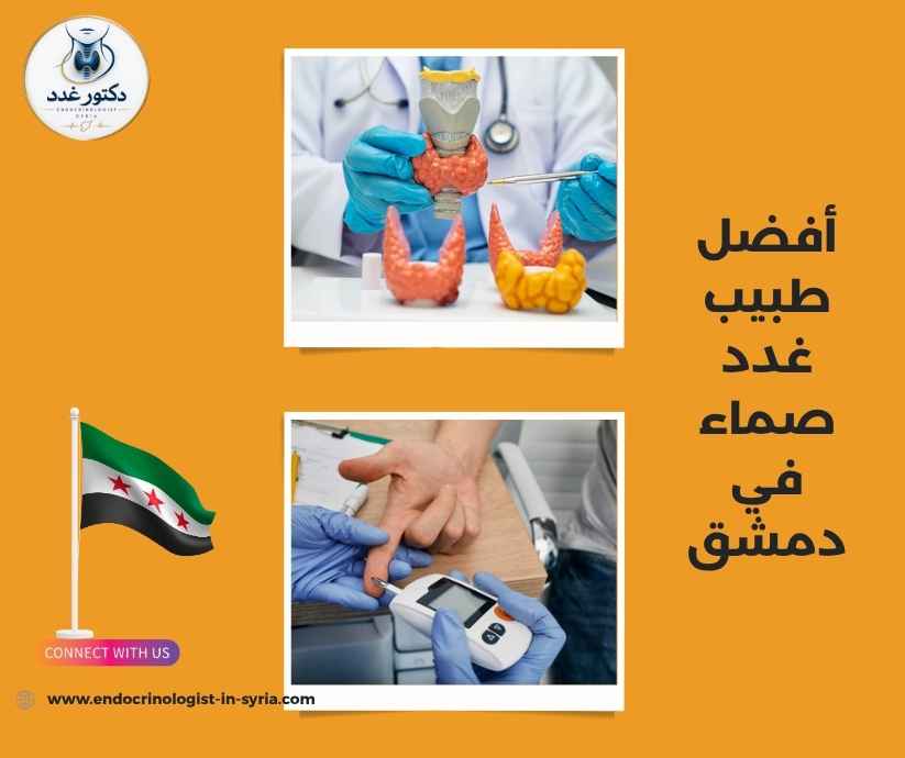 أفضل طبيب غدد صماء في دمشق