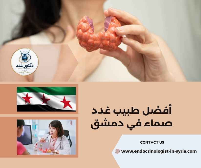 أفضل طبيب غدد صماء في دمشق
