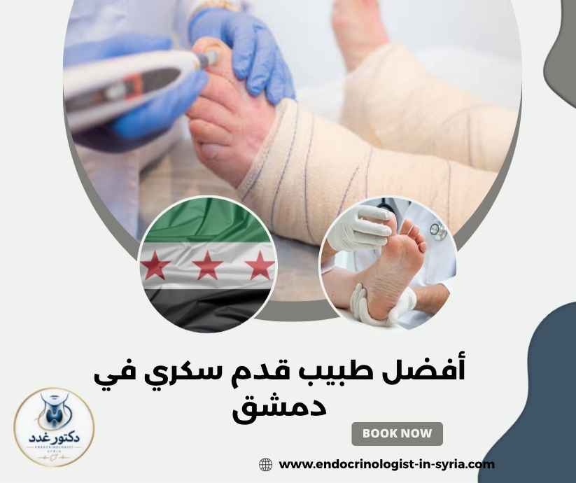 أفضل طبيب قدم سكري في دمشق أفضل طبيب قدم سكري في دمشق