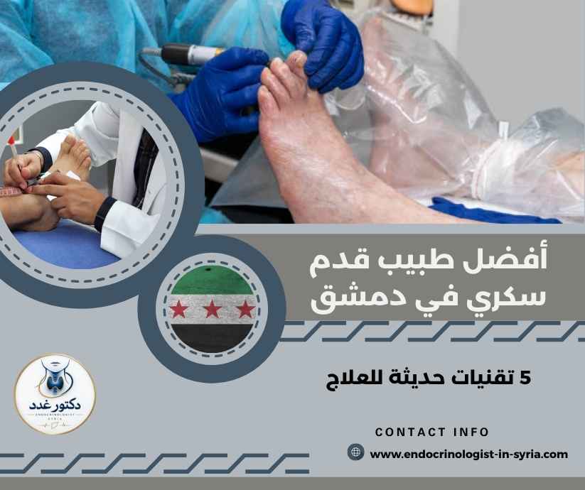 أفضل طبيب قدم سكري في دمشق