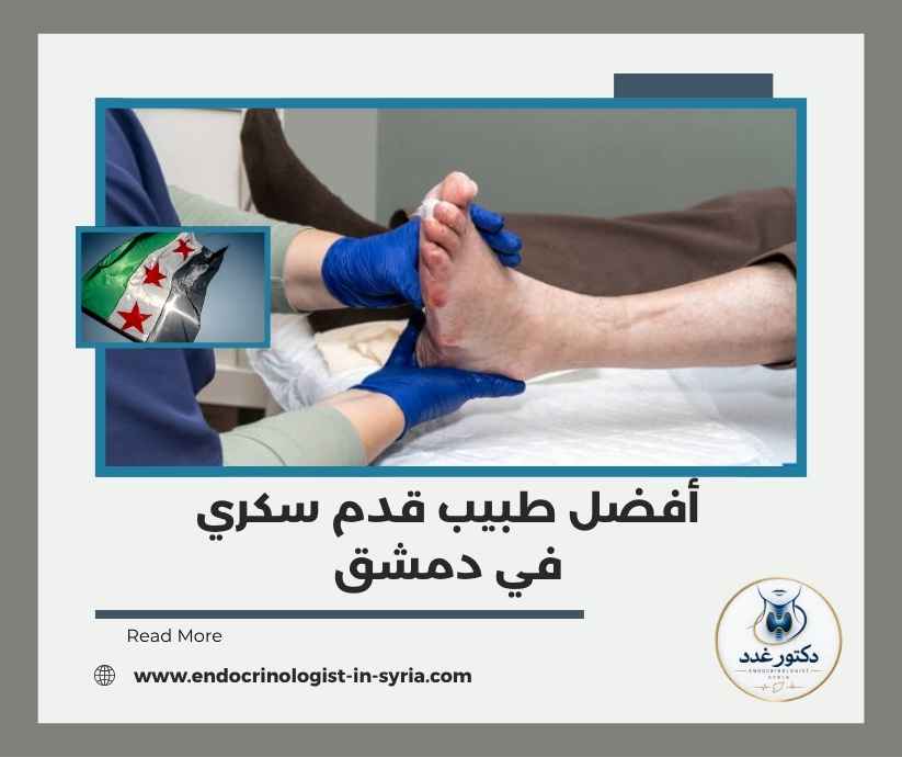 أفضل طبيب قدم سكري في دمشق أفضل طبيب قدم سكري في دمشق