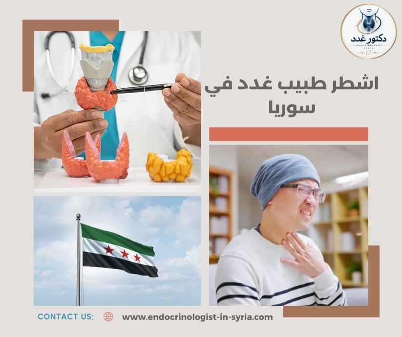 اشطر طبيب غدد في سوريا اشطر طبيب غدد في سوريا
