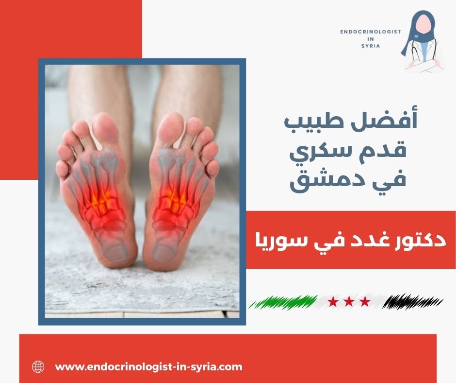 دكتور غدد في جرمانا دكتور غدد في جرمانا