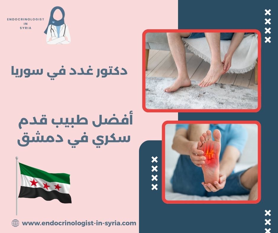 أفضل طبيب قدم سكري في دمشق