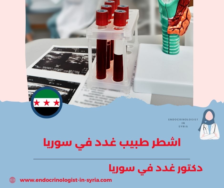 دكتور غدد شارع بغداد دمشق دكتور غدد شارع بغداد دمشق