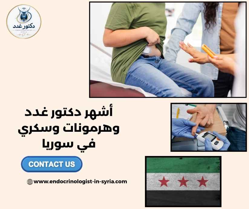 أشهر دكتور غدد وهرمونات وسكري في سوريا أشهر دكتور غدد وهرمونات وسكري في سوريا