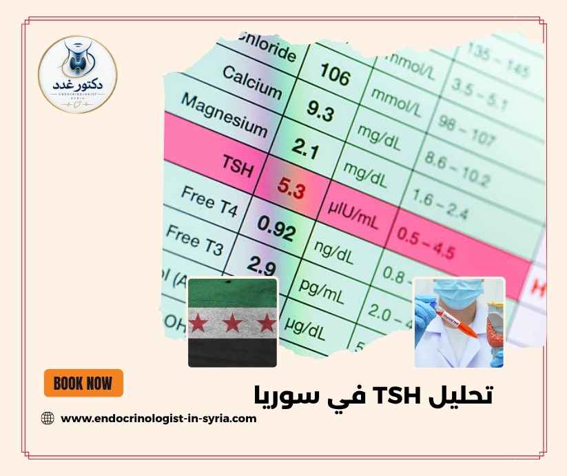 تحليل TSH في سوريا 