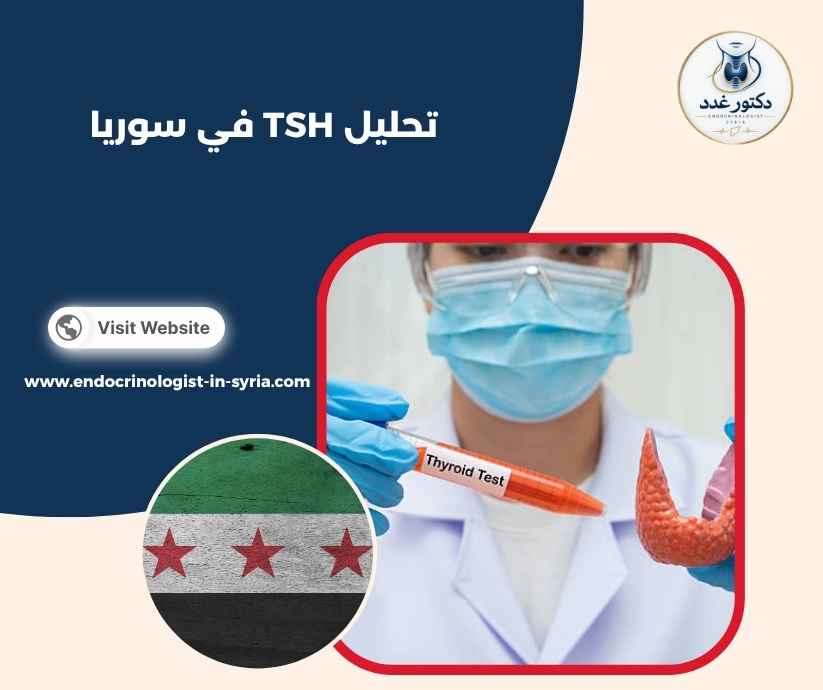 تحليل TSH في سوريا 