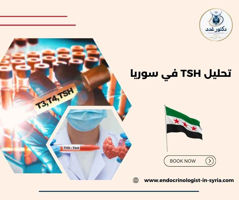 تحليل TSH في سوريا 