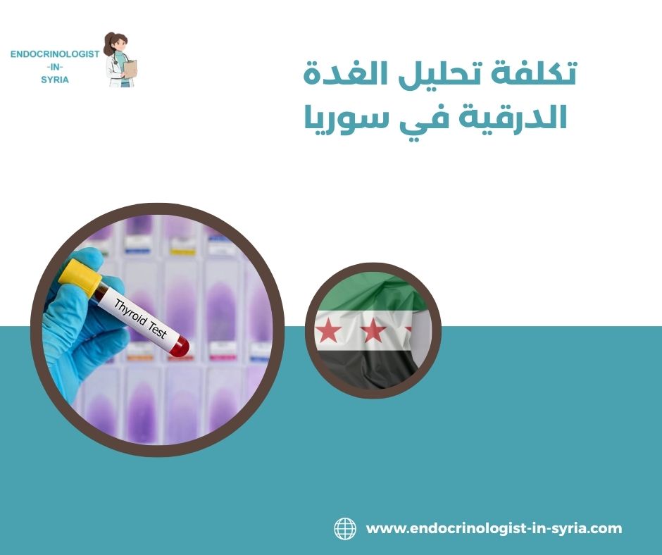 أنواع تحاليل الغدة الدرقية في سوريا أنواع تحاليل الغدة الدرقية في سوريا