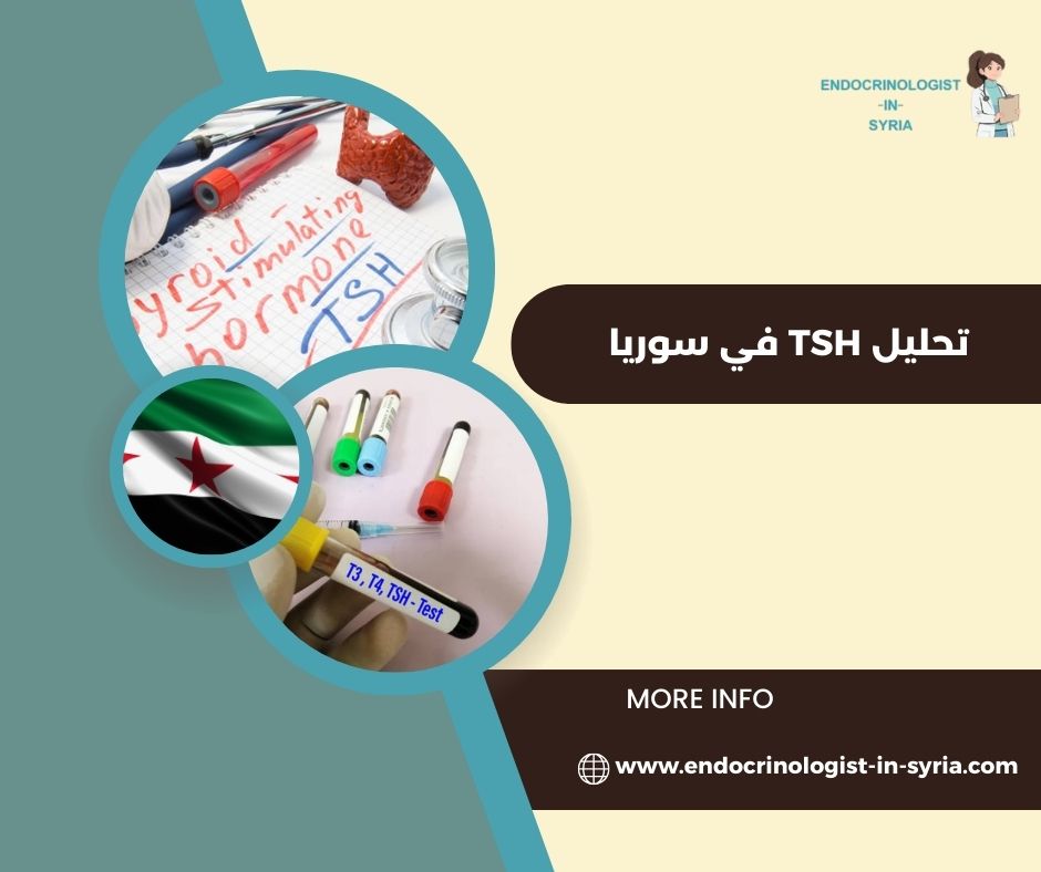 ما هو تحليل TSH في سوريا؟
