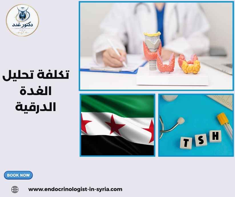 تكلفة تحليل الغدة الدرقية