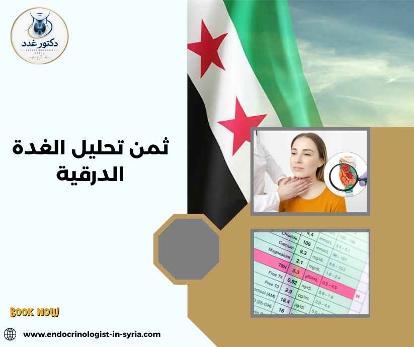 ثمن تحليل الغدة الدرقية