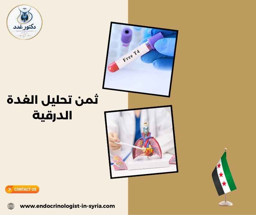 ثمن تحليل الغدة الدرقية