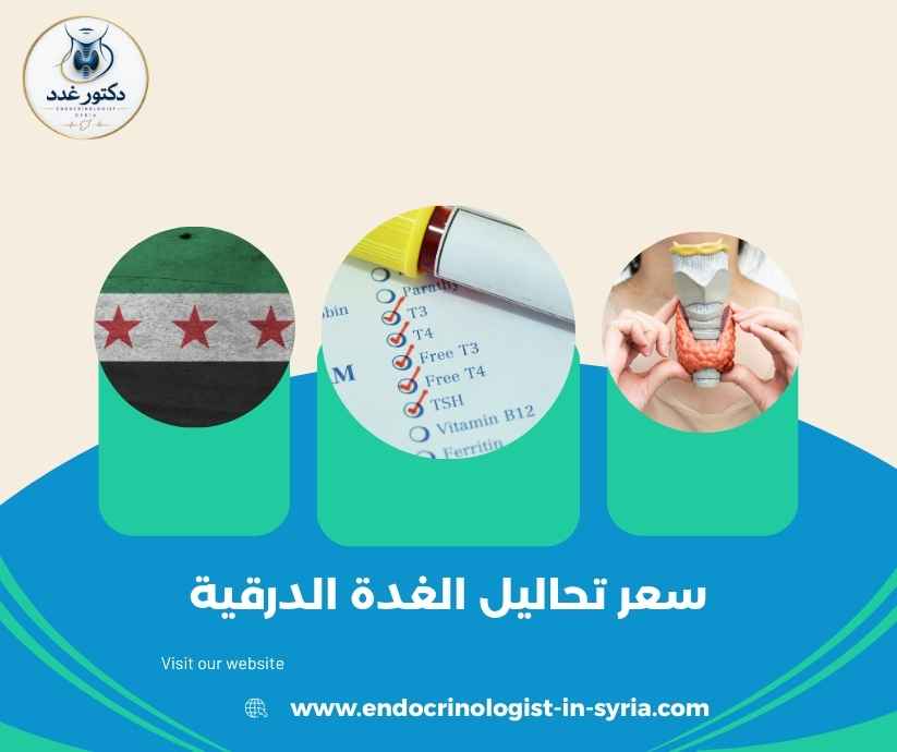 سعر تحاليل الغدة الدرقية