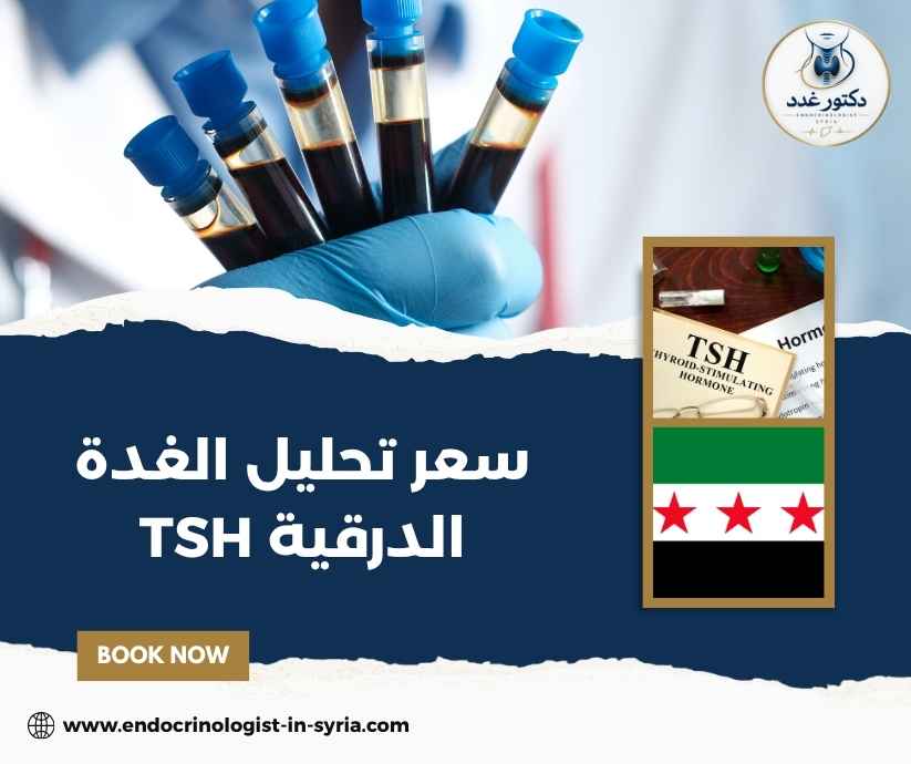 سعر تحليل الغدة الدرقية TSH