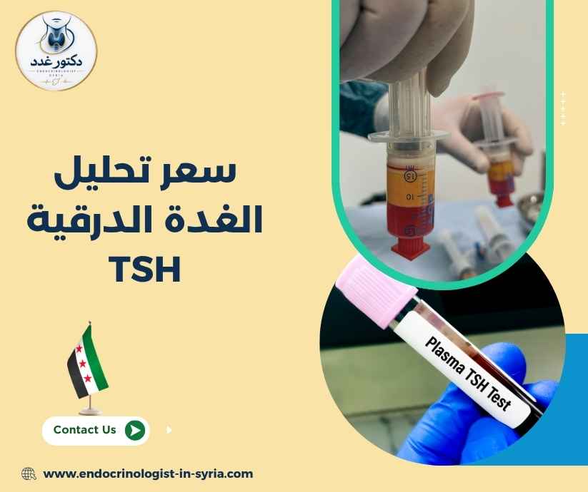 سعر تحليل الغدة الدرقية TSH