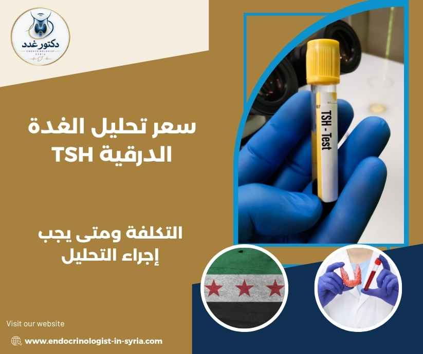 سعر تحليل الغدة الدرقية TSH