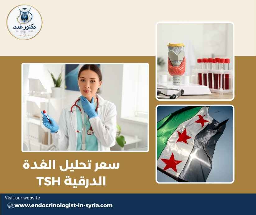 سعر تحليل الغدة الدرقية TSH