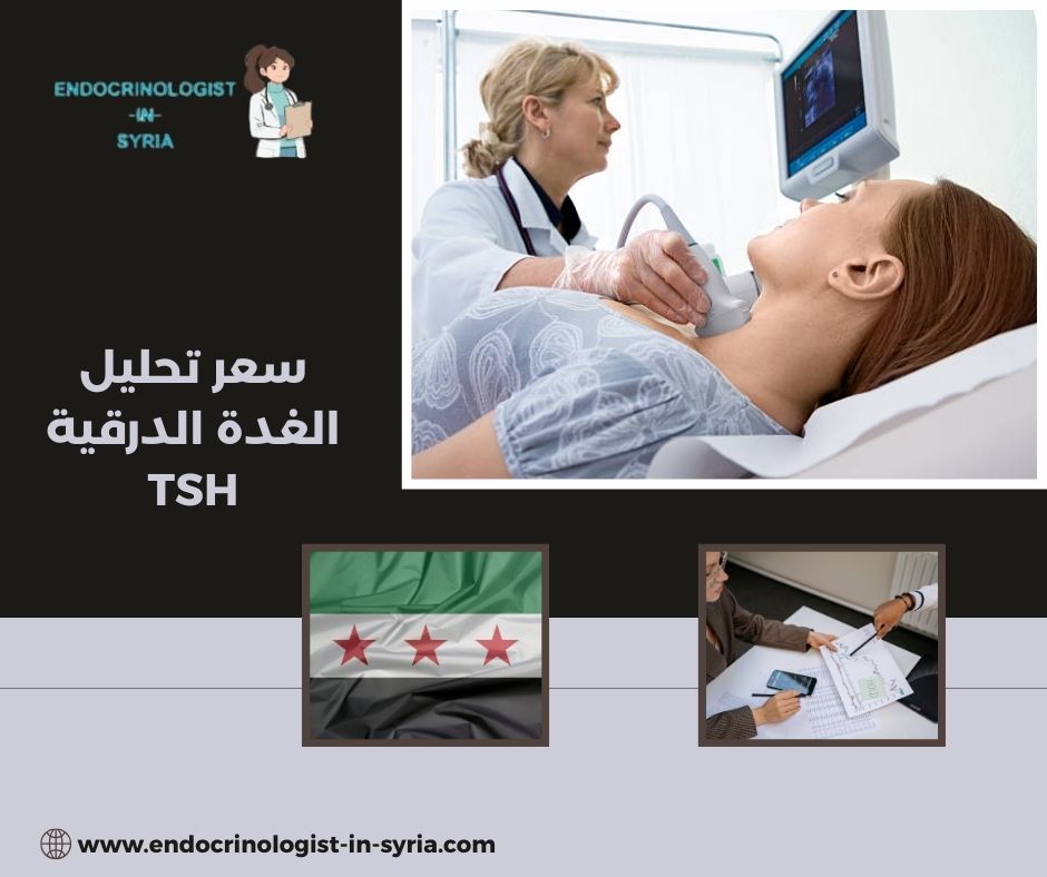 سعر تحليل الغدة الدرقية TSH