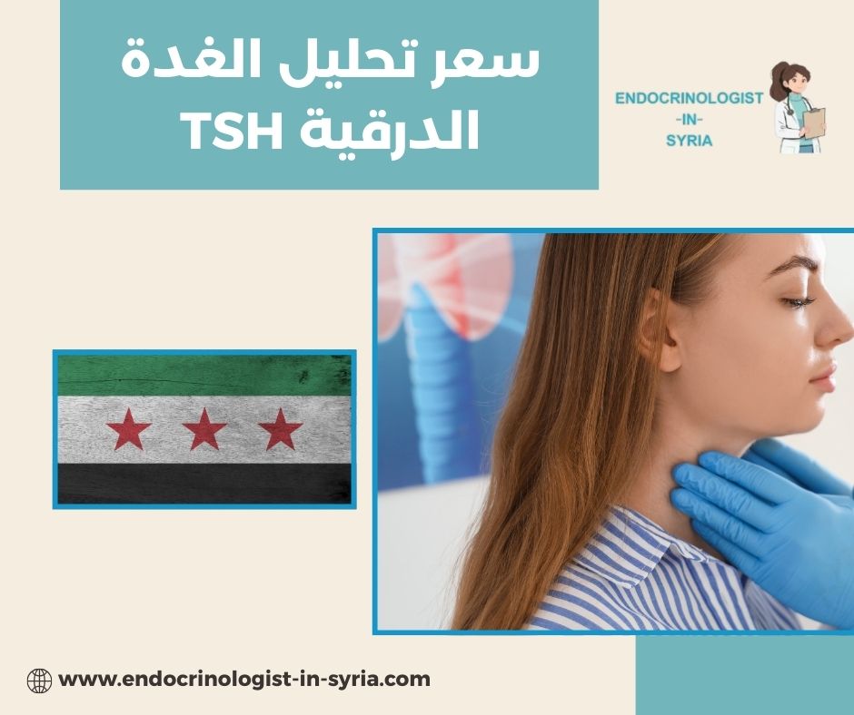 سعر تحليل الغدة الدرقية TSH