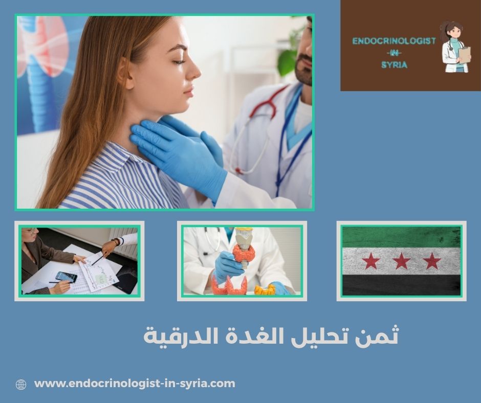 ثمن تحليل الغدة الدرقية