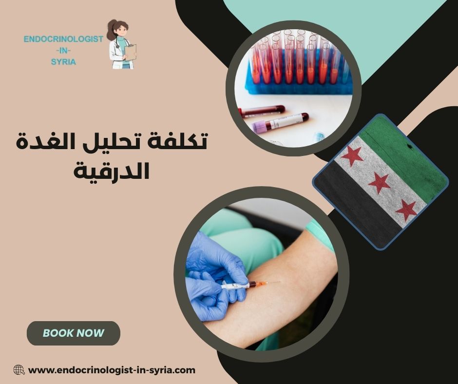 الأعراض الشائعة لاضطرابات الغدة الدرقية