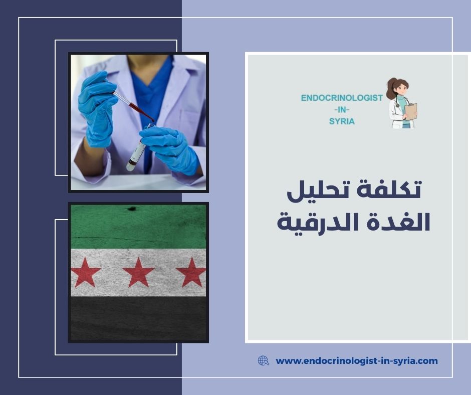 أنواع تحاليل الغدة الدرقية