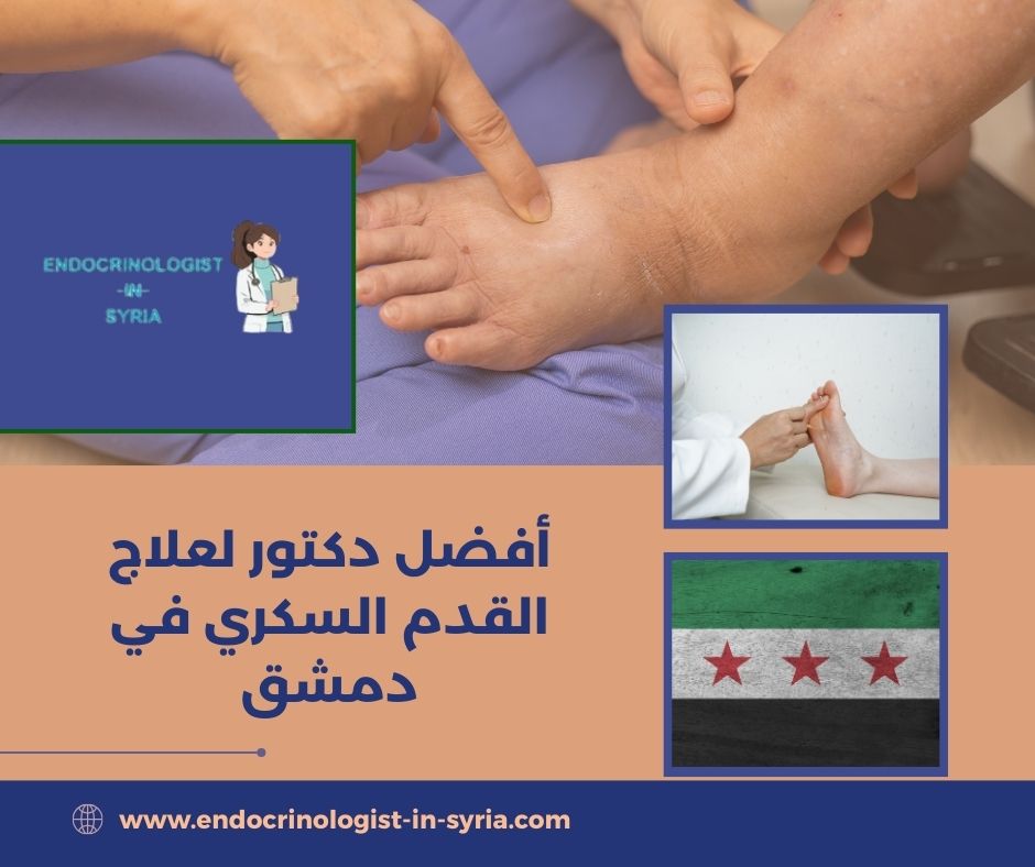 أفضل دكتور لعلاج القدم السكري في دمشق