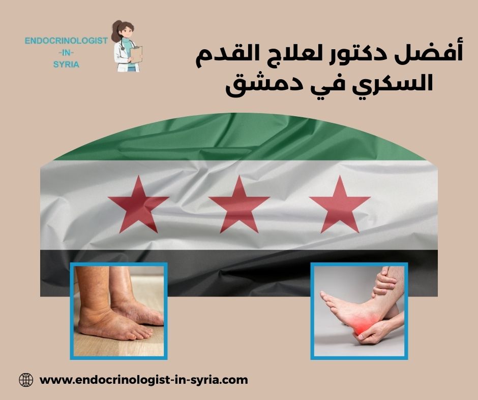 أفضل دكتور لعلاج القدم السكري في دمشق